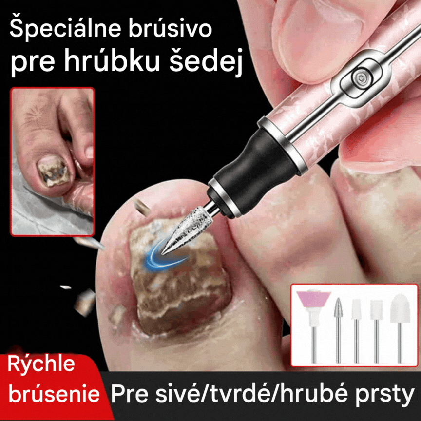 💅👍Elektrický pilník na nechty na liečbu onychomykózy