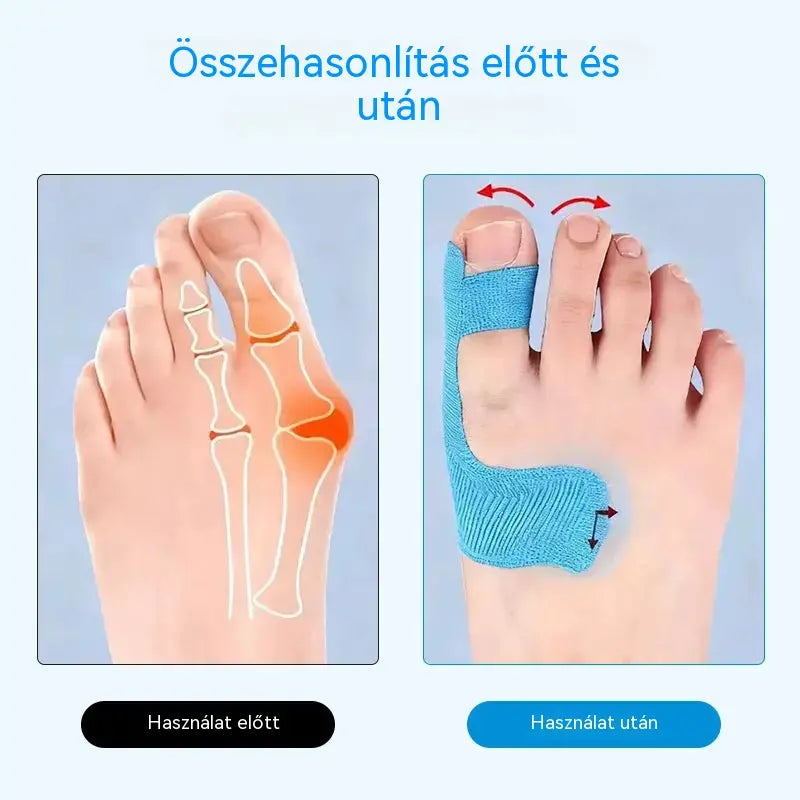 🌞🎉[50/100 darab] Rugalmas ujjvédők, égési sérülésekre való tapaszok, tartós sportkötések