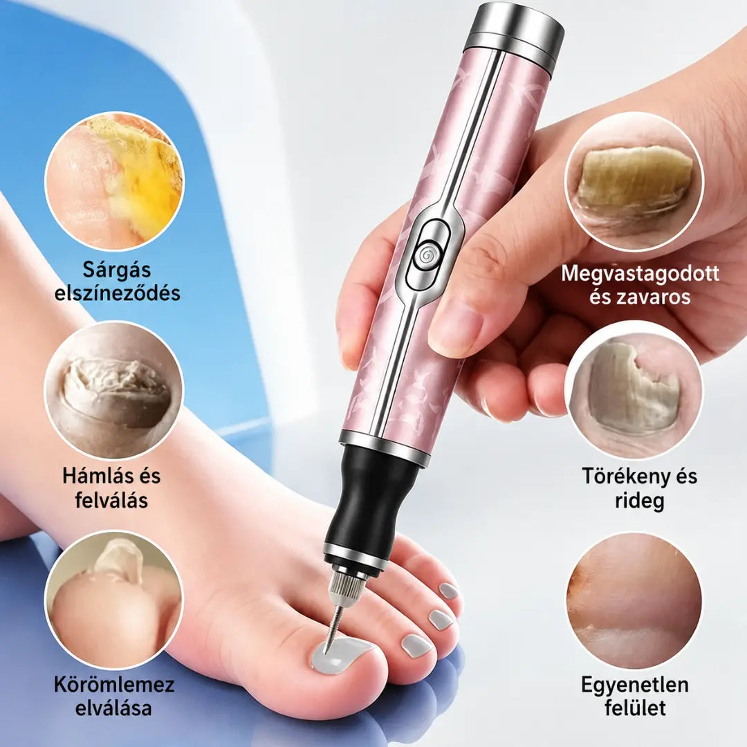 Elektromos körömreszelő onychomycosis kezelésére