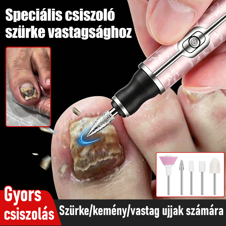 💅👍Elektromos körömreszelő onychomycosis kezelésére